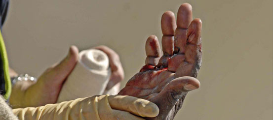 Rusts and breaks easily